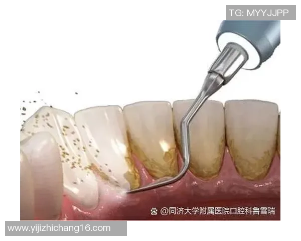 踢足球牙的趣味与挑战探讨如何在运动中保护口腔健康 踢足球牙的趣味与挑战探讨如何在运动中保护口腔健康